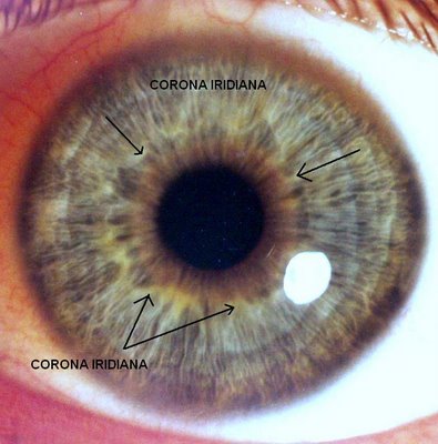  - corona-iridiana-iris